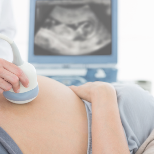 Preterm Birth: Preventing it From Happening Again